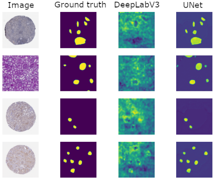 Segmentation results